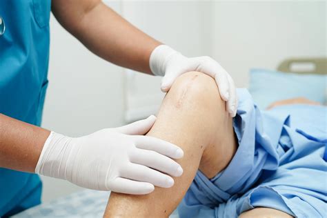 Biological Knee Replacements - London Sports Orthopaedics