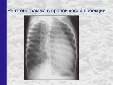 Рентгенанатомия грудной клетки - презентация онлайн