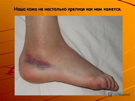 Презентация на тему: "Кожа – надежная защита организма. Выполнила ...
