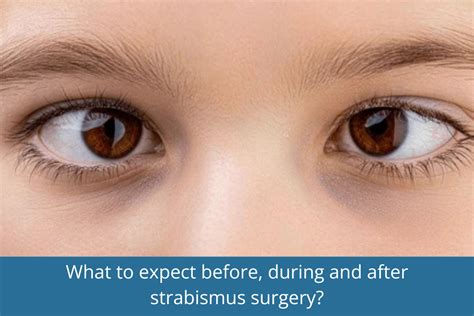 expect  eye muscle surgery