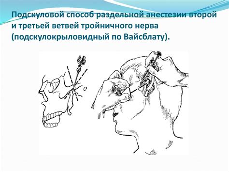 Стволовые методы анестезии ЧЛО - презентация онлайн