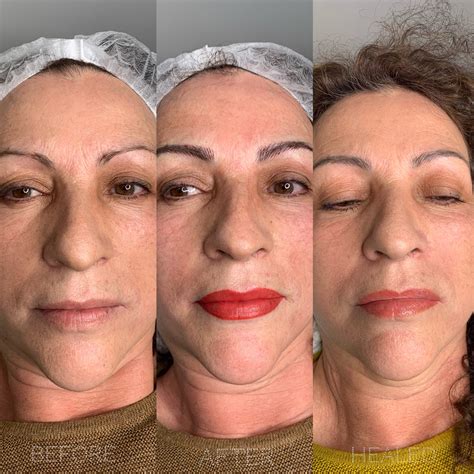 cosmetic tattoo for lips 6