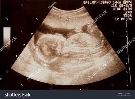 sonogram stock photo  shutterstock