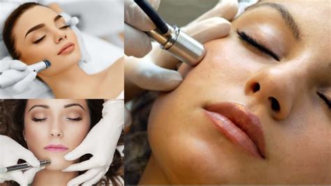 Surprising Benefits of Microdermabrasion | Benefits and Uses