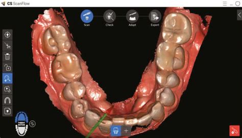 dexis medimatch dental laboratory