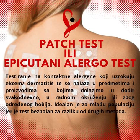 Epikutani test ili PATCH test je... - Poliklinika Vitalis