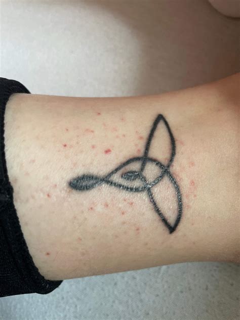 Ausschlag tattoo? (Körper, Haut, Entzündung)