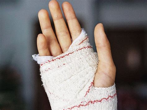 staph infection contagious duration signs transmission medical