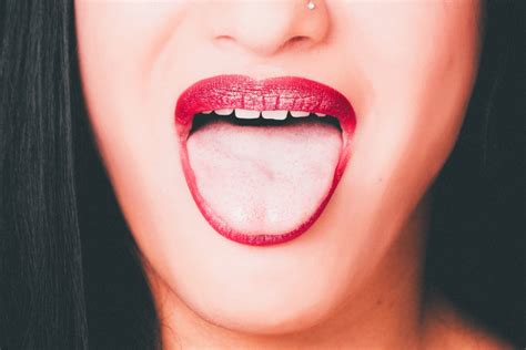 Alteraciones orofaciales tratada con logopedia - Clínica Fuensalud