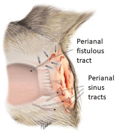 In Situ Treatment of Refractory Perianal Fistulas in Dogs with Low-Dose