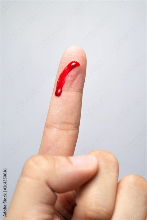 Bleeding blood from the cut finger wound. Injured finger with bleeding ...