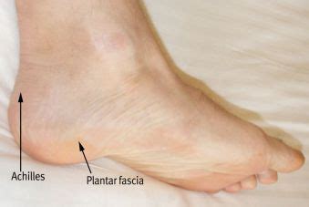 Figure 4: Surface anatomy showing comparative locations ('X') of ...