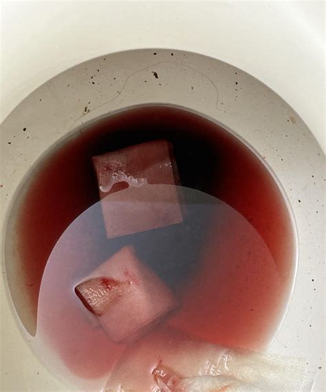 Don T Wait This Alarming Flow Might Be Your Body S Cry For Help news