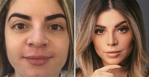 Gkay Antes E Depois Cirurgia - Gkay diz que ama fazer cirurgias plásticas; confira antes e depois da ...