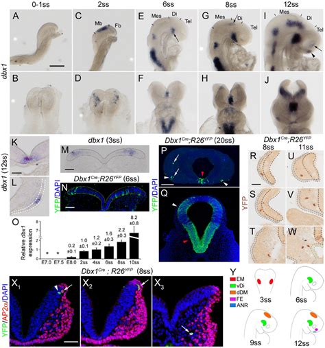 Dbx1 expression and tracing. (A-J) Dbx1 expression analysed by ...