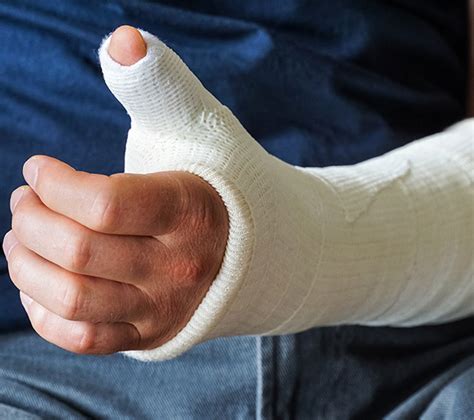 Broken Bone Treatment Sterling, VA | Millennium Medical Care Stone Springs