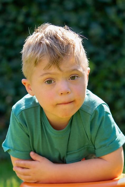 Sindrom Down Wajah Anak Laki - Foto gratis di Pixabay - Pixabay