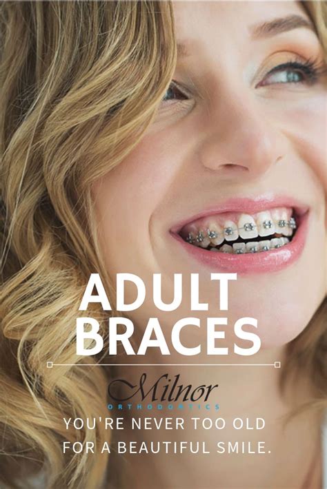 Braces for Adults | Orthodontics, Dental braces, Dental advertising