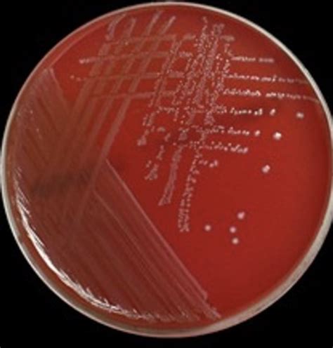 solved    hemolysis reaction   blood  cheggcom
