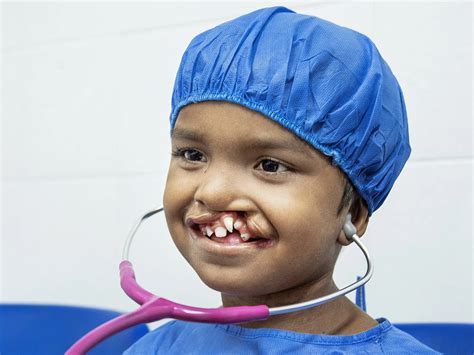 Meet Our Patients | Operation Smile