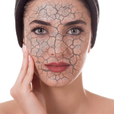 Fix Dry Skin - NutriFix
