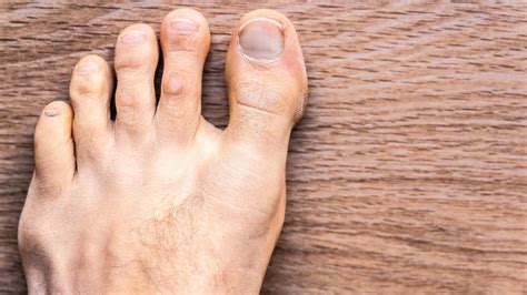 toes cramp   run