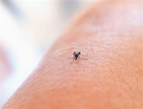 Why does our skin itch when a mosquito bites us? - Prospera Biotech