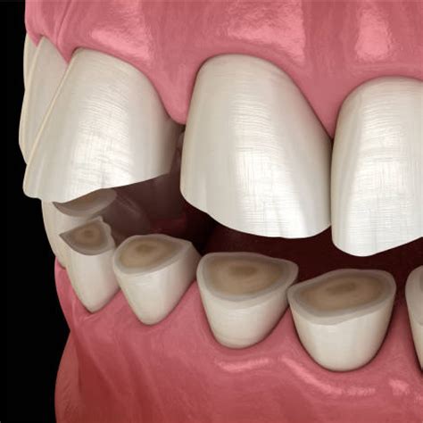 Dental Articles | Good Living Medical Centre