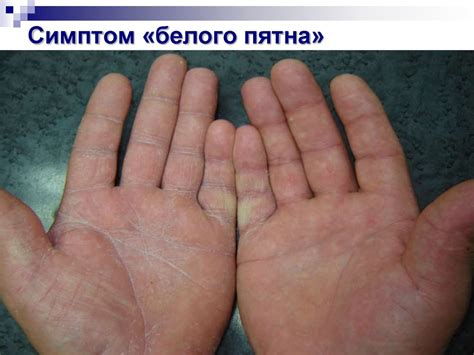 Вибрационная болезнь и нейросенсорная тугоухость - презентация онлайн