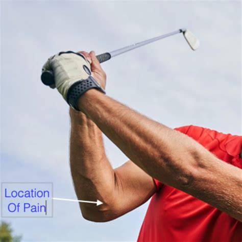 Golfers Elbow Pain Treatment in Raleigh, NC | Raleigh Hand to Shoulder Center