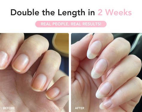 UltraGrow Nail Serum - Liaison Growth