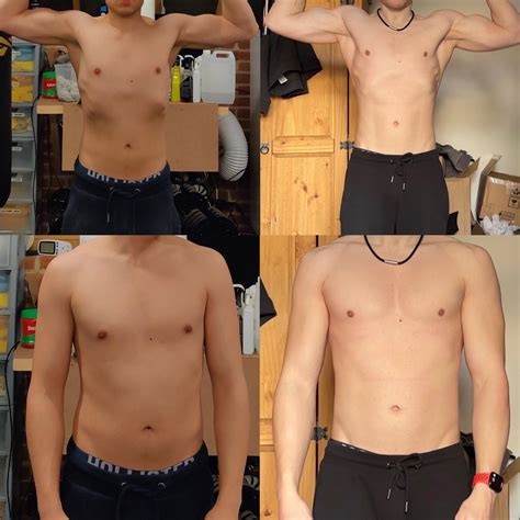 11 months mild scoliosis symmetry progression, iv been training like a