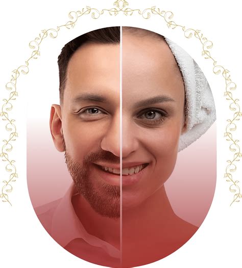 Gender Change Cosmetic Surgery at Nancy Hutchinson blog