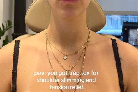 Trap tox treatment: Everything you need to know.