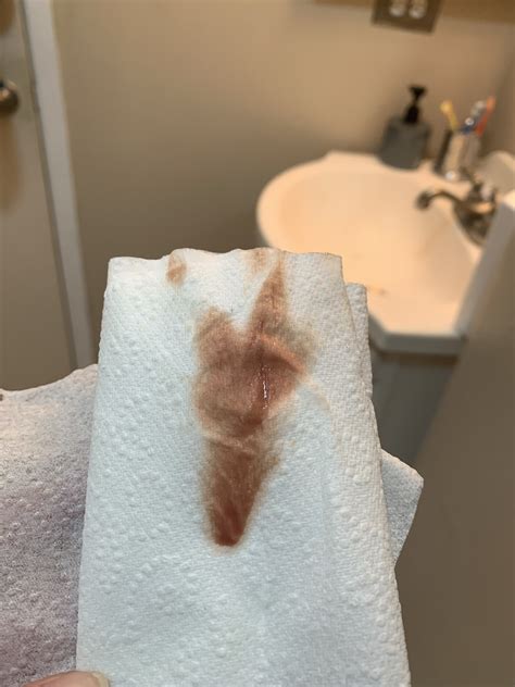 Implantation Bleeding