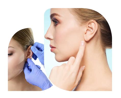 Ear Surgery | Otoplasty | Cleveland Cosmetic Surgery