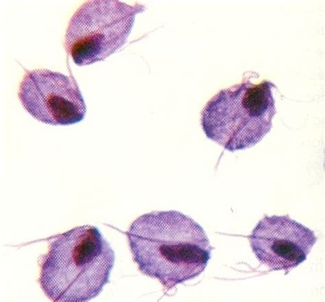 Trichomonas vaginalis ~ Detailed Information | Photos | Videos