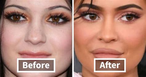 Nucelebs: Before & After Photos You Have To See! - 1kt32hv