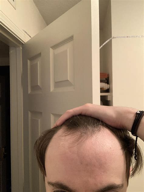 This haircut for men with bangs trick fixes a receding hairline 34