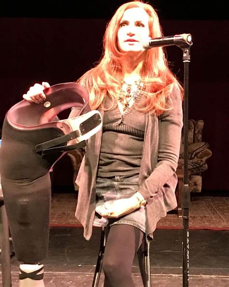 Theresa Sareo-Amputee sings of her survival, success - Amputee Site