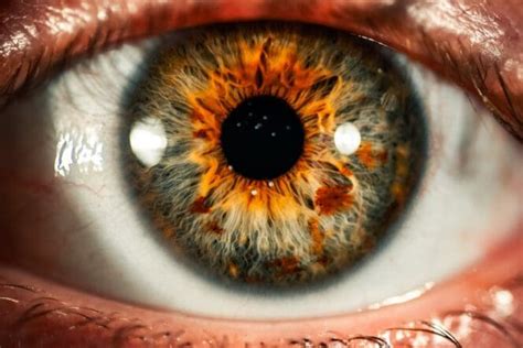 Narrow-Angle Glaucoma: Signs, Causes, and Treatment | MyVision.org