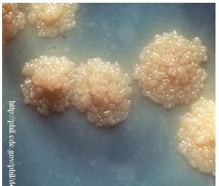 Mycobacterium bacteria lecture Flashcards | Quizlet
