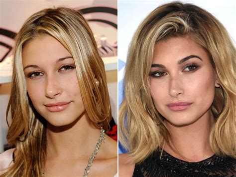 Hailey Bieber Antes E Depois