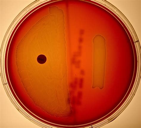 What antibiotic treats strep viridans