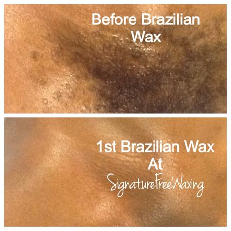 Brazilian Wax Pictures Before And After - Job Porn