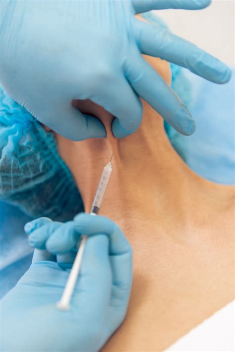 HATE YOUR NECK!!! What are those “BANDS” in my neck? | Kronowitz