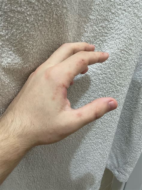 Guys would you help me couse of that ill. I went to 3 doctors, they