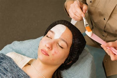 Acne Treatment at Doctor. Applying Facial Mask Stock Image - Image of dermatology, girl: 277007837