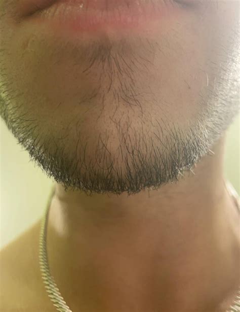 chin hair   month progress rminoxbeards