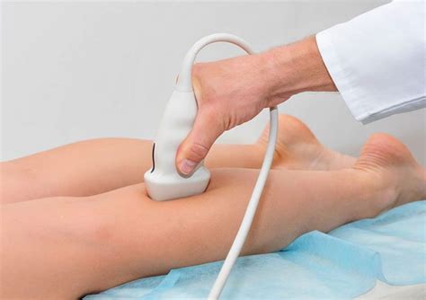 Como É Feito O Exame Doppler Das Pernas - Doutor, para que serve o exame doppler das pernas? – CardioRio Exames